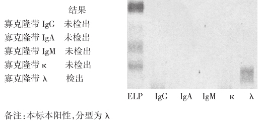 图4 免疫固定电泳结果